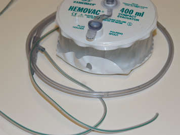 Photo of a Hemovac