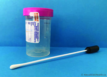 Container for coughing up a sputum sample and a swab for taking a throat swab