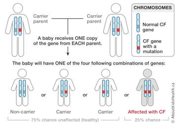 Cystic fibrosis inheritance showing that for a baby to be affected with cystic fibrosis they need to inherit one copy of CF gene from each parent