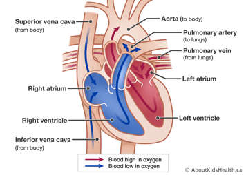 Normal heart showing placement of the atria, ventricles, aorta, superior vena cava, inferior vena cava, pulmonary artery and pulmonary veins