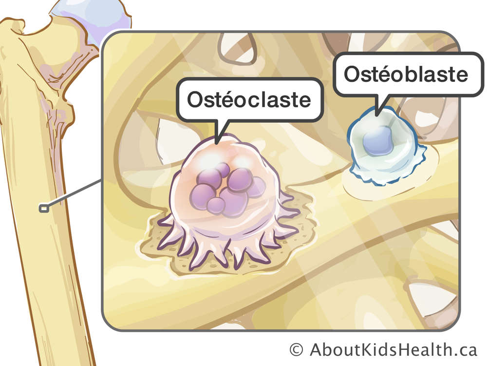 Illustration des ostéoclastes et des ostéoblastes dans l'os