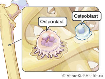 Illustration of osteoclast and osteoblast in a bone