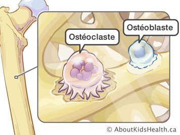 Illustration des ostéoclastes et des ostéoblastes dans l'os